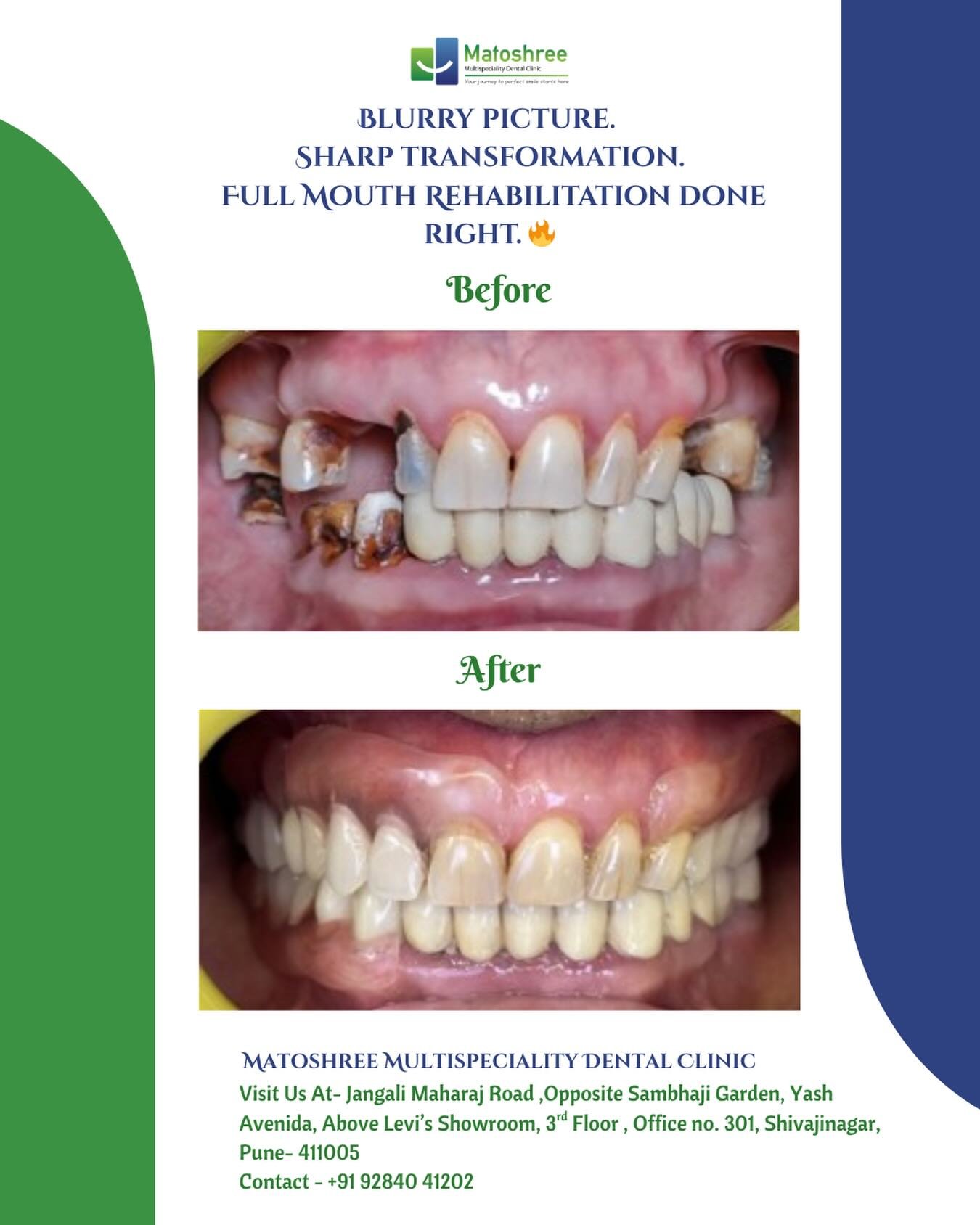 case study 11